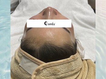 コンフィ(Comfy)/ハーブピーリング直後
