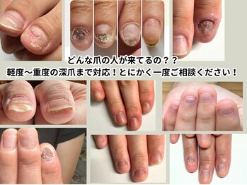 みんな同じ悩みを持っています