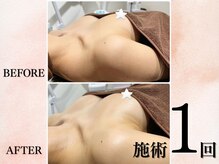 アンベリール(Embellir)