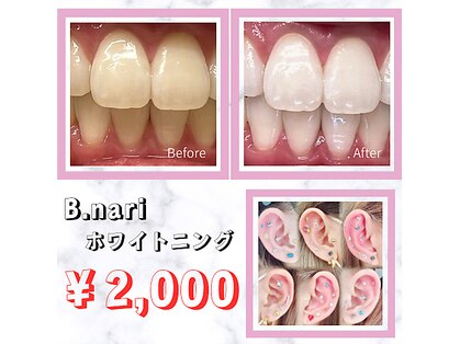 ビナリ(B,nari)の写真