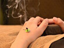 ほぐしてコリとる/鍼とお灸の組み合わせ