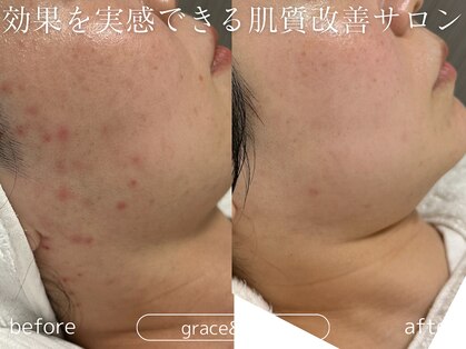 グレイス アンド ミューズ(grace&muse)の写真