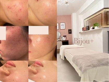 ビジュープラス 水戸店(Bijou+)の写真