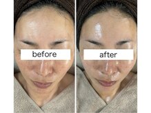 リボン(Ribbon)/人気No.1シミたるみ改善