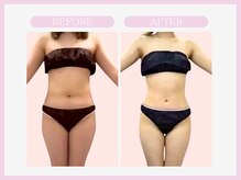 スリムライン 弘前店(The Slim Line)/before→after