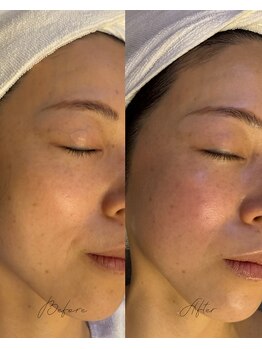 ダイダイ(daidai)/before→after　3回目