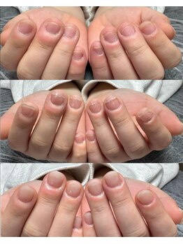 リミズネイルビューティー 名駅店(RimisNailxbeauty)/深爪・噛み爪改善 自然な自爪