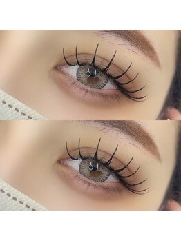 ソア(soa.)/LED100本（Mamiko施術）