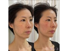 ココロニコル 今治店/