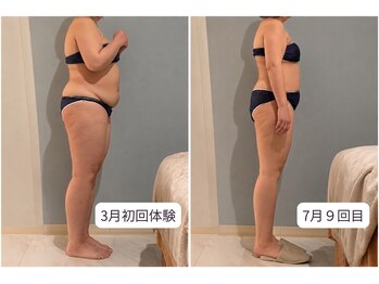 ルーモアンド(Lumo&)の写真/【3ヶ月で-10cmの実績】口コミ5.0★ 本気で変わりたい方へ｜結果重視のボディケア|ブライダルエステ