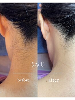 ブラジリアンワックス専門店 アンジー(ANGIE)/うなじデザイン1