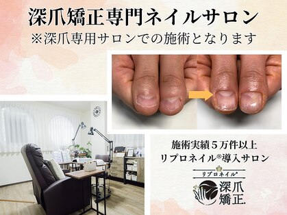 エルナ(elna)の写真