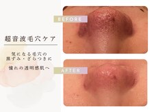 カオヤ プラス(Kaoya plus)の雰囲気（毛穴洗浄の効果実証◎写真多数掲載中）
