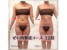 ハナチュチュ 矢場町店(Hanachuchu)の雰囲気（ぜい肉撃退コース12回★3ヶ月でぽっこりお腹消滅！！栄痩身No.1!）