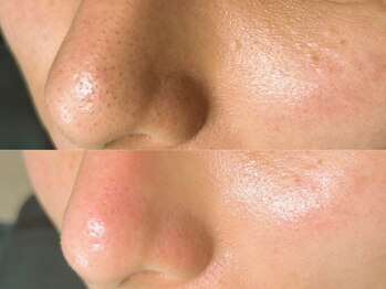 メイククラッシュ 錦糸町(Make●Crush)の写真/眉毛スタイリング×毛穴洗浄でお顔のトータルケアが叶う♪男性専門店なので、お気軽にご相談ください♪