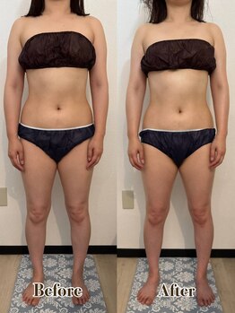 ルリエ(Relier)/全身筋膜コルギ