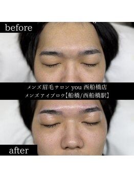 ユー 西船橋店(you)/ビフォーアフター写真