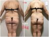 【人気急上昇】大人女性本気痩せ★セルゼロ2×漢方温活デトックス ¥41800