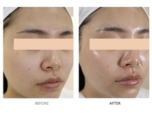 ナチュリー(Naturry)の雰囲気（毛穴改善と水光肌が叶う！すっぴんでも自信あるお肌に。）