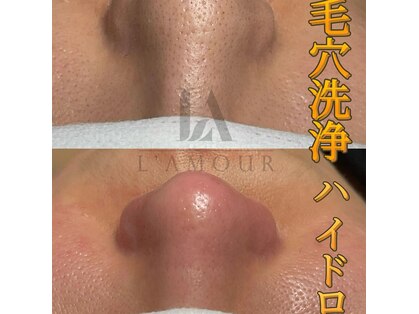 ラ ムールの写真