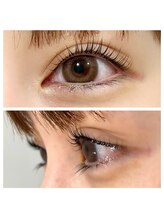 ソート(THOUGHT)/ラッシュリフト