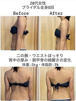 ヌーボ(NUeVo)/ブライダル1ヶ月集中コース(5回)