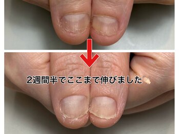 レアムネイル(Leam nail)/2週間半でこんなに伸びました！