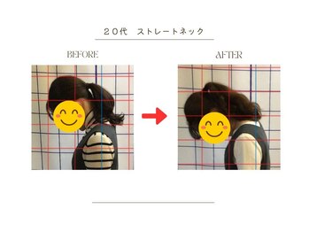 ストレッチ 整体 ホープ(HOPE)/デスクワークでの首の柔軟性