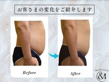 アンドエム(&M)の雰囲気（3回目施術後の変化。整えた状態が戻りにくい施術です。）