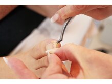 ドクターネイル爪革命 京都出町店/【巻き爪矯正】足専門の技術