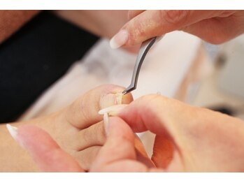 ドクターネイル爪革命 京都出町店/【巻き爪矯正】足専門の技術