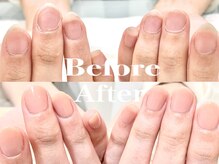 ネイルサロン オー(Oh!)/劇 的☆深爪改善！Before→After