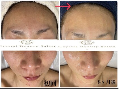 クリスタルビューティーサロン(Crystal Beauty Salon)の写真