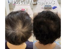 ルチル(Rutile)/頭皮プロセルセラピーズ