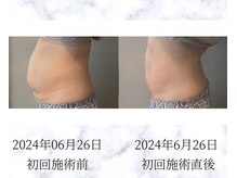 サロン ド メデューズ 札幌店(Salon de meduse)の雰囲気（月1回の自分メンテナンス/アップデート!プロに任せてみませんか?）