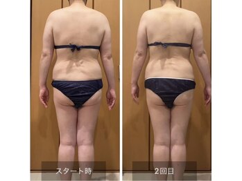 ルリアンデュレ(le lien durer)/肩こりのお客さま、2回目の施術