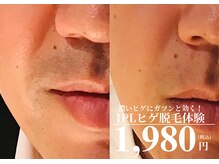 メンズ エステティック ヒーロー(men's esthetic HERO)