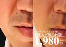 メンズ エステティック ヒーロー(men's esthetic HERO)