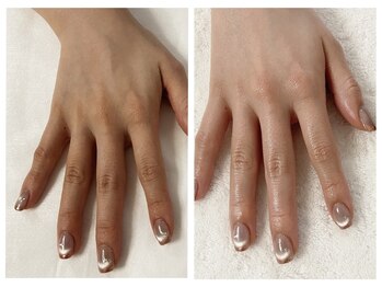 キレイテ 福岡天神店/30代のお客様