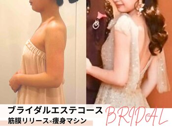 ミルズ(MillS)/ブライダルエステコース