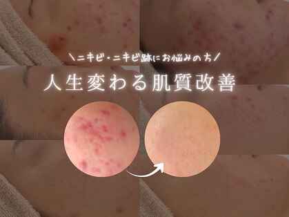 ニコレ(Nicore)の写真