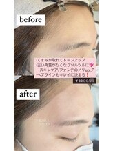 ブラン 磐田店(Blanc)/おでこWAX