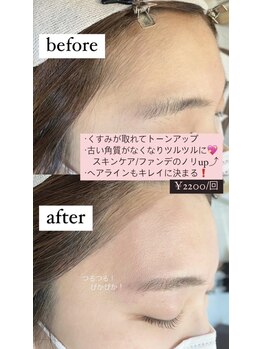 ブラン 磐田店(Blanc)/おでこWAX