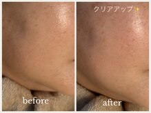 グランボヌール(grand bonheur)/【バクテリウムピール】