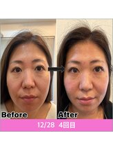 中野パーソナル整体院/美容鍼