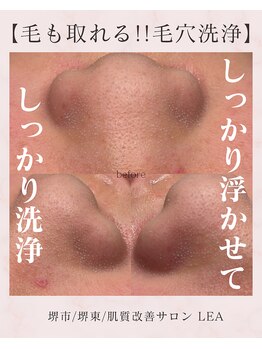 レア(Lea)/こんなに詰まってます！