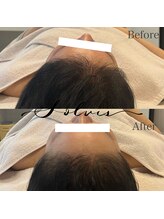 ソルヴィス(SOLVIS)/