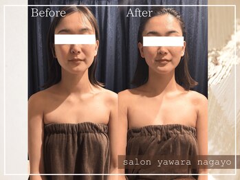 ヤワラ 長与店(yawara)/πテラピーBefore After