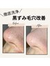 黒ずみ・毛穴　【話題のエクソソーム】徹底毛穴洗浄　￥15400→