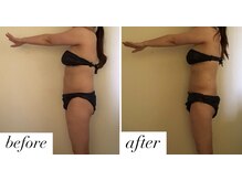 ベルシア(Bellucia)/